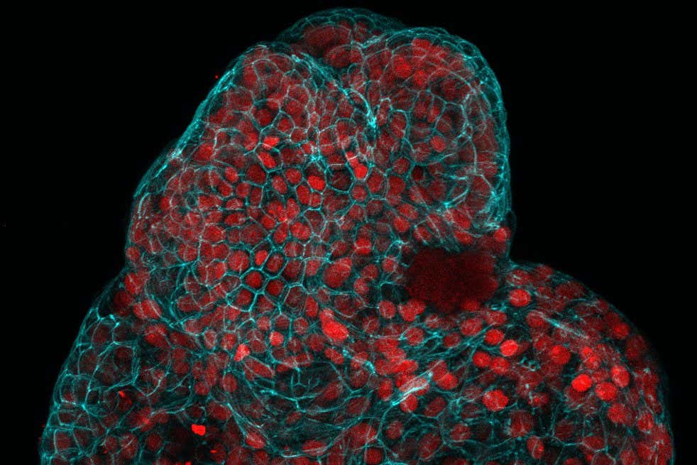 Balls of lung cells grown from amniotic fluid. The red indicates lung stem cells